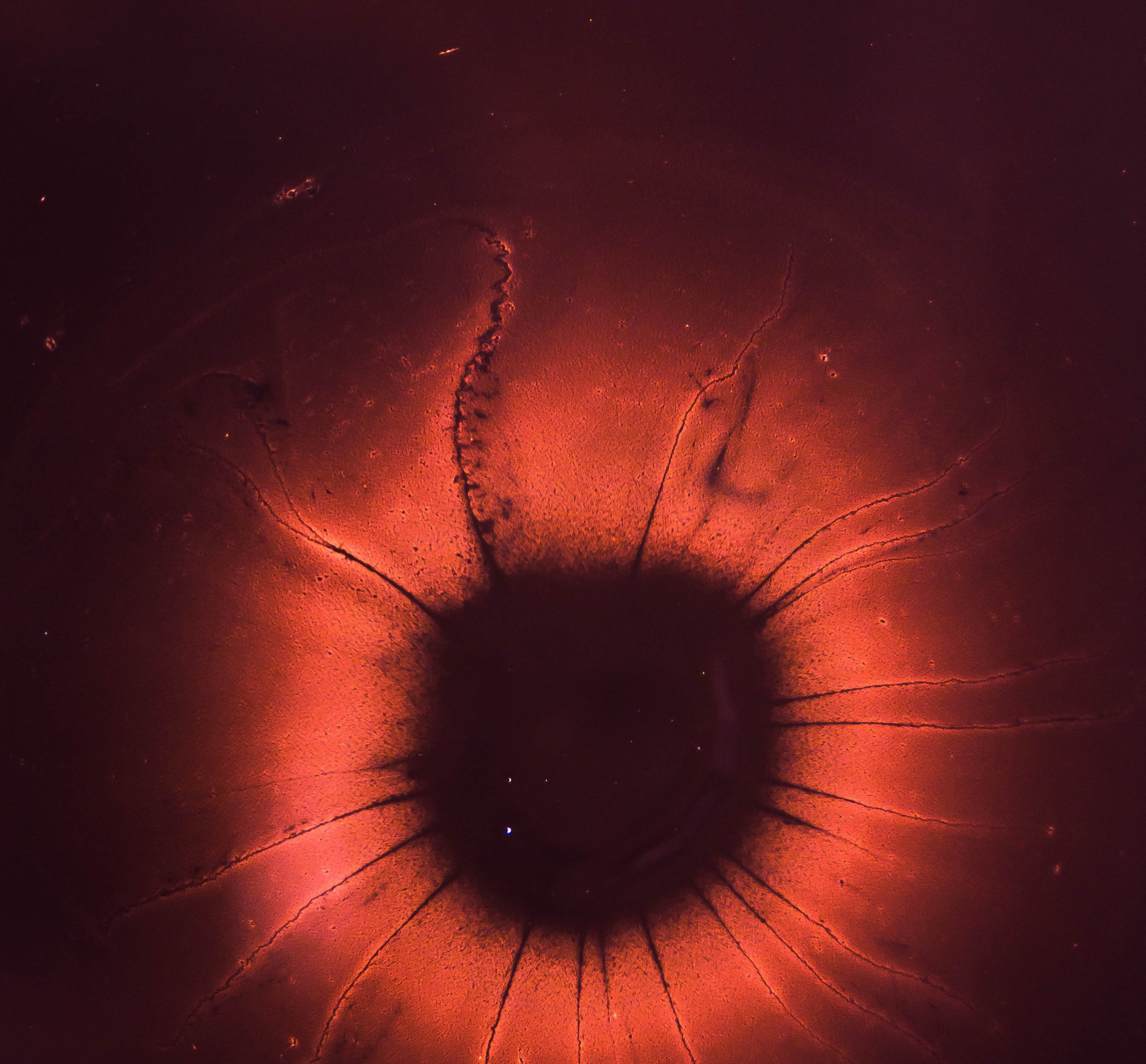 Medical Image Segmentation